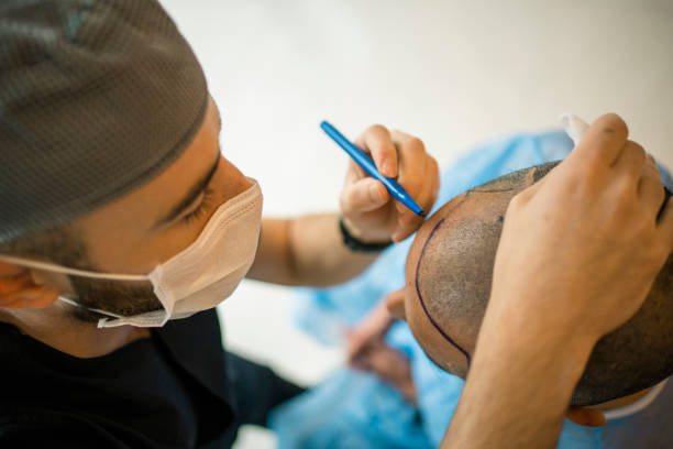 Hair transplant Hair transplant