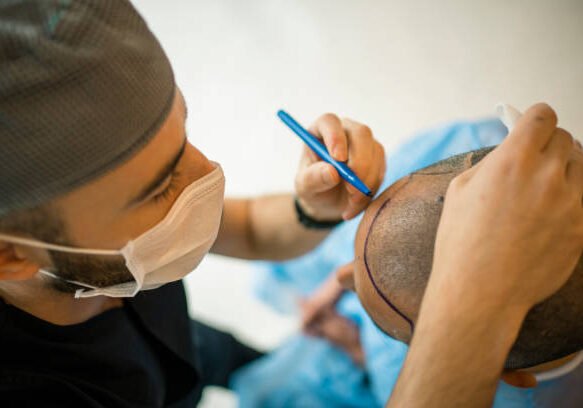 Hair transplant